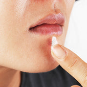 LALARECIPE Trouble Spot Patch — нанесення патча на прищ біля губ для швидкого загоєння